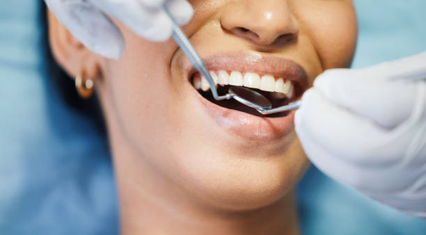 Best Walk-In Emergency Dentist in Milton, GA