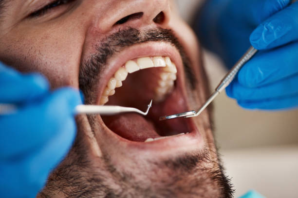 Best Emergency Orthodontic Repairs in Milton, GA