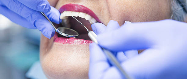 Best Walk-In Emergency Dentist in Milton, GA